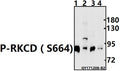 Western blot (WB) analysis of p-RKCD (S664) pAb at 1:500 dilution
Lane1:Hela whole cell lysate(10ug)
Lane2:A549 whole cell lysate(40ug)
Lane3:The Uterus tissue lysate of Mouse(20ug)
Lane4:The Uterus tissue lysate of Rat(20ug)