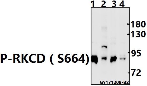 Western blot (WB) analysis of p-RKCD (S664) pAb at 1:500 dilution
Lane1:Hela whole cell lysate(10ug)
Lane2:A549 whole cell lysate(40ug)
Lane3:The Uterus tissue lysate of Mouse(20ug)
Lane4:The Uterus tissue lysate of Rat(20ug)