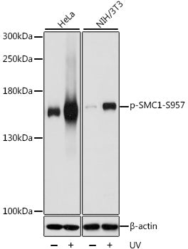 Phospho-SMC1-S957 polyclonal antibody – Figure 1 of 5