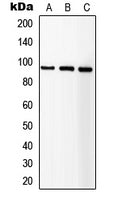 Western blot analysis of extracts from normal  and IGF1R knockout  293T cells, using IGF1R antibody  at 1:3000 dilution.
Secondary antibody: HRP Goat Anti-Rabbit IgG   at 1:10000 dilution.
Lysates/proteins: 25ug per lane.
Blocking buffer: 3% nonfat dry milk in TBST.
Detection: ECL Basic Kit .
Exposure time: 10s.