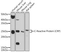 Western blot analysis of extracts of various cell lines, using C-Reactive Protein ) antibody  at 1:1000 dilution.
Secondary antibody: HRP Goat Anti-Rabbit IgG   at 1:10000 dilution.
Lysates/proteins: 25ug per lane.
Blocking buffer: 3% nonfat dry milk in TBST.
Detection: ECL Basic Kit .
Exposure time: 90s.