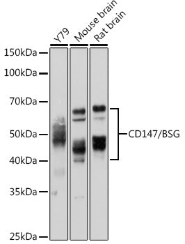 Western blot analysis of extracts of various cell lines, using CD147/CD147/BSG antibody  at 1:1000 dilution.
Secondary antibody: HRP Goat Anti-Rabbit IgG   at 1:10000 dilution.
Lysates/proteins: 25ug per lane.
Blocking buffer: 3% nonfat dry milk in TBST.
Detection: ECL Basic Kit .
Exposure time: 5s.