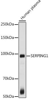 Western blot analysis of extracts of Human plasma, using SERPING1  antibody  at 1:1000 dilution.
Secondary antibody: HRP Goat Anti-Rabbit IgG   at 1:10000 dilution.
Lysates/proteins: 25ug per lane.
Blocking buffer: 3% nonfat dry milk in TBST.
Detection: ECL Basic Kit .
Exposure time: 30s.