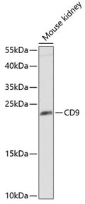 Western blot analysis of various lysates, using CD9 antibody  at 1:7504 dilution.
Secondary antibody: HRP Goat Anti-Rabbit IgG   at 1:10000 dilution.
Lysates/proteins: 25ug per lane.
Blocking buffer: 3% nonfat dry milk in TBST.
Detection: ECL Basic Kit .
Exposure time: 60s.