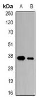 Western blot analysis of CDK6 expression in Jurkat (A), K562 (B) whole cell lysates.