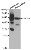 CYP2E1 polyclonal antibody - Figure 1 of 1