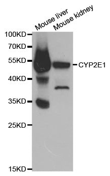 CYP2E1 polyclonal antibody - Figure 1 of 1