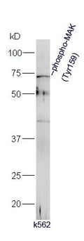 Primary: rabbit Anti-phospho-MAK (Tyr159)  at 1:300;