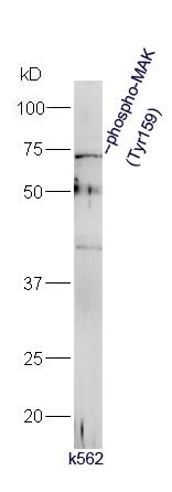 Primary: rabbit Anti-phospho-MAK (Tyr159)  at 1:300;