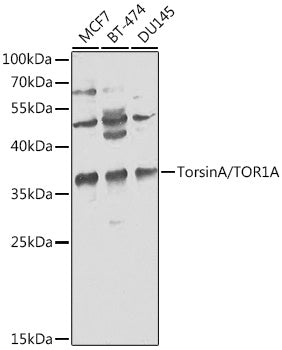 Western blot analysis of extracts of various cell lines, using TorsinA/TOR1A antibody  at 1:1000 dilution.
Secondary antibody: HRP Goat Anti-Rabbit IgG   at 1:10000 dilution.
Lysates/proteins: 25ug per lane.
Blocking buffer: 3% nonfat dry milk in TBST.