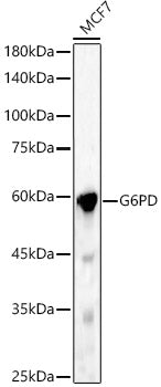 Western blot analysis of MCF7, using G6PD antibody  at  1:500 dilution.
Secondary antibody: HRP Goat Anti-Rabbit IgG   at 1:10000 dilution.
Lysates/proteins: 25ug per lane.
Blocking buffer: 3% nonfat dry milk in TBST.
Detection: ECL Basic Kit .
Exposure time: 5s.