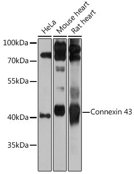 Western blot analysis of extracts of various cell lines, using Connexin 43 antibody  at 1:1000 dilution.
Secondary antibody: HRP Goat Anti-Rabbit IgG   at 1:10000 dilution.
Lysates/proteins: 25ug per lane.
Blocking buffer: 3% nonfat dry milk in TBST.
Detection: ECL Basic Kit .
Exposure time: 30s.