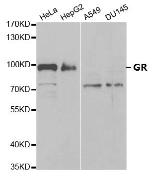 Immunohistochemistry of paraffin-embedded rat spleen using Glucocorticoid Receptor Rabbit pAb  at dilution of 1:100 .Perform high pressure antigen retrieval with 10 mM citrate buffer pH 6.0 before commencing with IHC staining protocol.