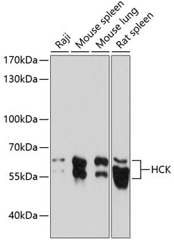 Western blot analysis of extracts of various cell lines, using HCK antibody  at 1:1000 dilution.
Secondary antibody: HRP Goat Anti-Rabbit IgG   at 1:10000 dilution.
Lysates/proteins: 25ug per lane.
Blocking buffer: 3% nonfat dry milk in TBST.
Detection: ECL Basic Kit .
Exposure time: 90s.