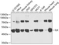 Western blot analysis of extracts of various cell lines, using ILK antibody  at 1:1000 dilution.
Secondary antibody: HRP Goat Anti-Rabbit IgG   at 1:10000 dilution.
Lysates/proteins: 25ug per lane.
Blocking buffer: 3% nonfat dry milk in TBST.