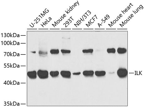 Western blot analysis of extracts of various cell lines, using ILK antibody  at 1:1000 dilution.
Secondary antibody: HRP Goat Anti-Rabbit IgG   at 1:10000 dilution.
Lysates/proteins: 25ug per lane.
Blocking buffer: 3% nonfat dry milk in TBST.