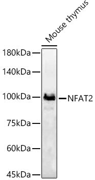 Western blot analysis of Mouse thymus, using NFAT2 antibody  at 1:630 dilution.
Secondary antibody: HRP Goat Anti-Rabbit IgG   at 1:10000 dilution.
Lysates/proteins: 25ug per lane.
Blocking buffer: 3% nonfat dry milk in TBST.
Detection: ECL Basic Kit .
Exposure time: 180s.