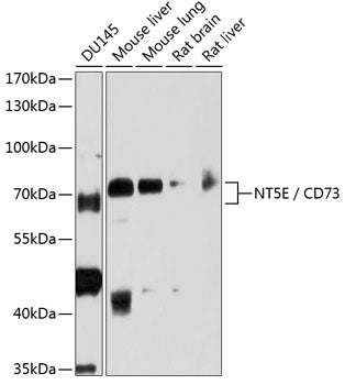 Western blot analysis of extracts of various cell lines, using CD73/NT5E antibody  at 1:1000 dilution.
Secondary antibody: HRP Goat Anti-Rabbit IgG   at 1:10000 dilution.
Lysates/proteins: 25ug per lane.
Blocking buffer: 3% nonfat dry milk in TBST.
Detection: ECL Basic Kit .
Exposure time: 1s.