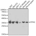 Western blot analysis of extracts of various cell lines, using PPP4C antibody  at 1:1000 dilution.
Secondary antibody: HRP Goat Anti-Rabbit IgG   at 1:10000 dilution.
Lysates/proteins: 25ug per lane.
Blocking buffer: 3% nonfat dry milk in TBST.