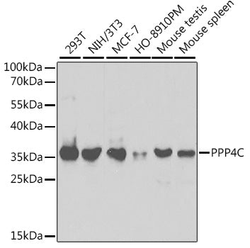 Western blot analysis of extracts of various cell lines, using PPP4C antibody  at 1:1000 dilution.
Secondary antibody: HRP Goat Anti-Rabbit IgG   at 1:10000 dilution.
Lysates/proteins: 25ug per lane.
Blocking buffer: 3% nonfat dry milk in TBST.