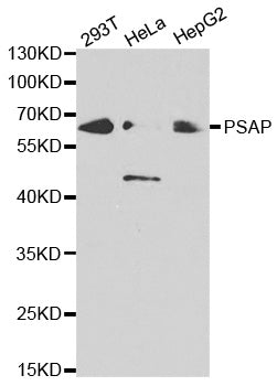 Western blot analysis of extracts of various cell lines, using PSAP antibody  at 1:500 dilution.
Secondary antibody: HRP Goat Anti-Rabbit IgG   at 1:10000 dilution.
Lysates/proteins: 25ug per lane.
Blocking buffer: 3% nonfat dry milk in TBST.
Detection: ECL Basic Kit .
Exposure time: 5s.