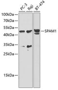 Western blot analysis of extracts of various cell lines, using SPAM1   antibody  at 1:1000 dilution.
Secondary antibody: HRP Goat Anti-Rabbit IgG   at 1:10000 dilution.
Lysates/proteins: 25ug per lane.
Blocking buffer: 3% nonfat dry milk in TBST.
Detection: ECL Basic Kit .
Exposure time: 10s.