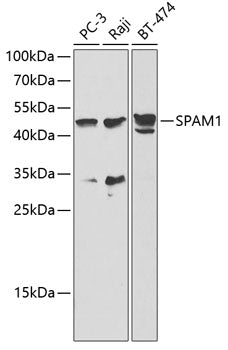 Western blot analysis of extracts of various cell lines, using SPAM1   antibody  at 1:1000 dilution.
Secondary antibody: HRP Goat Anti-Rabbit IgG   at 1:10000 dilution.
Lysates/proteins: 25ug per lane.
Blocking buffer: 3% nonfat dry milk in TBST.
Detection: ECL Basic Kit .
Exposure time: 10s.