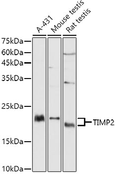 Western blot analysis of extracts of various cell lines, using TIMP2 antibody  at 1:1000 dilution.
Secondary antibody: HRP Goat Anti-Rabbit IgG   at 1:10000 dilution.
Lysates/proteins: 25ug per lane.
Blocking buffer: 3% nonfat dry milk in TBST.
Detection: ECL Basic Kit .
Exposure time: 60s.