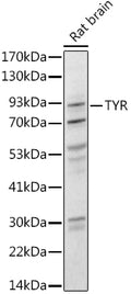 Western blot analysis of extracts of Rat brain, using Tyrosinase antibody  at 1:1000 dilution.
Secondary antibody: HRP Goat…