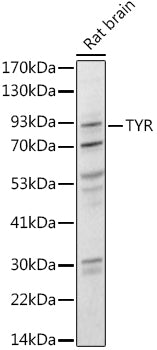 Western blot analysis of extracts of Rat brain, using Tyrosinase antibody  at 1:1000 dilution.
Secondary antibody: HRP Goat…