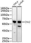 Western blot analysis of extracts of various cell lines, using Chk2 antibody  at 1:500 dilution.
Secondary antibody: HRP Goat Anti-Rabbit IgG   at 1:10000 dilution.
Lysates/proteins: 25ug per lane.
Blocking buffer: 3% nonfat dry milk in TBST.
Detection: ECL Basic Kit .
Exposure time: 30s.