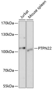 Western blot analysis of extracts of various cell lines, using PTPN22 antibody  at 1:1000 dilution.
Secondary antibody: HRP Goat Anti-Rabbit IgG   at 1:10000 dilution.
Lysates/proteins: 25ug per lane.
Blocking buffer: 3% nonfat dry milk in TBST.
Detection: ECL Basic Kit .
Exposure time: 5s.