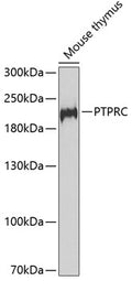 Western blot analysis of various lysates, using CD45 antibody  at  1:1510 dilution.
Secondary antibody: HRP Goat Anti-Rabbit IgG   at 1:10000 dilution.
Lysates/proteins: 25ug per lane.
Blocking buffer: 3% nonfat dry milk in TBST.
Detection: ECL Basic Kit .
Exposure time: 10s.