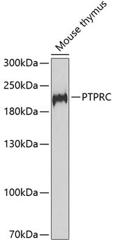 Western blot analysis of various lysates, using CD45 antibody  at  1:1510 dilution.
Secondary antibody: HRP Goat Anti-Rabbit IgG   at 1:10000 dilution.
Lysates/proteins: 25ug per lane.
Blocking buffer: 3% nonfat dry milk in TBST.
Detection: ECL Basic Kit .
Exposure time: 10s.