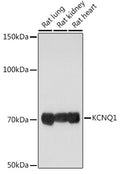 Western blot analysis of extracts of various cell lines, using KCNQ1 Rabbit pAb  at 1:1000 dilution.
Secondary antibody…