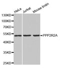 Western blot analysis of extracts of various cell lines, using PP2A-B55α/PR55α/PPP2R2A antibody  at 1:1000 dilution.
Secondary antibody: HRP Goat Anti-Rabbit IgG   at 1:10000 dilution.
Lysates/proteins: 25ug per lane.
Blocking buffer: 3% nonfat dry milk in TBST.