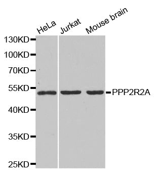 Western blot analysis of extracts of various cell lines, using PP2A-B55α/PR55α/PPP2R2A antibody  at 1:1000 dilution.
Secondary antibody: HRP Goat Anti-Rabbit IgG   at 1:10000 dilution.
Lysates/proteins: 25ug per lane.
Blocking buffer: 3% nonfat dry milk in TBST.