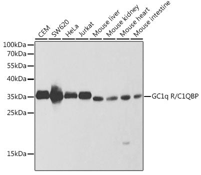 Western blot analysis of extracts of various cell lines, using GC1q R/GC1q R/C1QBP antibody  at 1:1000 dilution.
Secondary antibody: HRP Goat Anti-Rabbit IgG   at 1:10000 dilution.
Lysates/proteins: 25ug per lane.
Blocking buffer: 3% nonfat dry milk in TBST.
