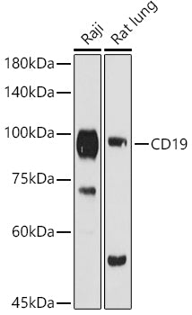 Western blot analysis of extracts of various cell lines, using CD19 antibody  at 1:1000 dilution.
Secondary antibody: HRP Goat Anti-Rabbit IgG   at 1:10000 dilution.
Lysates/proteins: 25ug per lane.
Blocking buffer: 3% nonfat dry milk in TBST.
Detection: ECL Basic Kit .
Exposure time: 90s.
