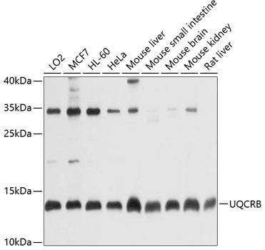 Western blot analysis of extracts of various cell lines, using UQCRB antibody  at 1:1000 dilution.
Secondary antibody: HRP Goat Anti-Rabbit IgG   at 1:10000 dilution.
Lysates/proteins: 25ug per lane.
Blocking buffer: 3% nonfat dry milk in TBST.
Detection: ECL Basic Kit .
Exposure time: 10s.