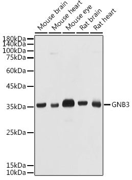 Western blot analysis of extracts of various cell lines, using GNB3 antibody  at 1:1000 dilution.
Secondary antibody: HRP Goat Anti-Rabbit IgG   at 1:10000 dilution.
Lysates/proteins: 25ug per lane.
Blocking buffer: 3% nonfat dry milk in TBST.
Detection: ECL Basic Kit .
Exposure time: 10s.