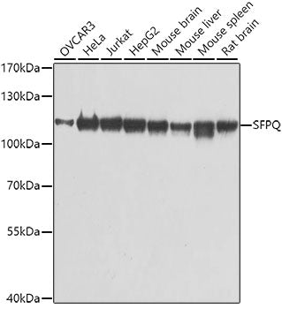 Western blot analysis of extracts of various cell lines, using SFPQ antibody  at 1:1000 dilution.
Secondary antibody: HRP Goat Anti-Rabbit IgG   at 1:10000 dilution.
Lysates/proteins: 25ug per lane.
Blocking buffer: 3% nonfat dry milk in TBST.
Detection: ECL Basic Kit .
Exposure time: 1s.