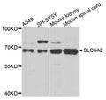 Western blot analysis of extracts of various cells, using SLC6A2 antibody.
