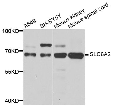 Western blot analysis of extracts of various cells, using SLC6A2 antibody.