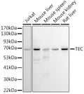 Western blot analysis of extracts of various cell lines, using Tec  antibody  at 1:1000 dilution.
Secondary antibody: HRP Goat Anti-Rabbit IgG   at 1:10000 dilution.
Lysates/proteins: 25ug per lane.
Blocking buffer: 3% nonfat dry milk in TBST.
DeTection: ECL Basic Kit .
Exposure time: 90s.