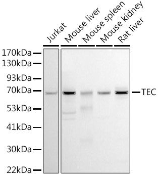 Western blot analysis of extracts of various cell lines, using Tec  antibody  at 1:1000 dilution.
Secondary antibody: HRP Goat Anti-Rabbit IgG   at 1:10000 dilution.
Lysates/proteins: 25ug per lane.
Blocking buffer: 3% nonfat dry milk in TBST.
DeTection: ECL Basic Kit .
Exposure time: 90s.