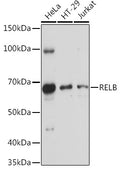 Western blot analysis of extracts of various cell lines, using RELB antibody  at 1:1000 dilution.
Secondary antibody: HRP Goat Anti-Rabbit IgG   at 1:10000 dilution.
Lysates/proteins: 25ug per lane.
Blocking buffer: 3% nonfat dry milk in TBST.
Detection: ECL Basic Kit .
Exposure time: 30s.