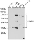 Western blot analysis of extracts of various cell lines, using PLAUR antibody  at 1:1000 dilution.
Secondary antibody: HRP Goat Anti-Rabbit IgG   at 1:10000 dilution.
Lysates/proteins: 25ug per lane.
Blocking buffer: 3% nonfat dry milk in TBST.
Detection: ECL Basic Kit .
Exposure time: 15s.