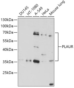 Western blot analysis of extracts of various cell lines, using PLAUR antibody  at 1:1000 dilution.
Secondary antibody: HRP Goat Anti-Rabbit IgG   at 1:10000 dilution.
Lysates/proteins: 25ug per lane.
Blocking buffer: 3% nonfat dry milk in TBST.
Detection: ECL Basic Kit .
Exposure time: 15s.
