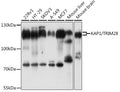 Western blot analysis of extracts of various cell lines, using KAP1/KAP1/TRIM28 antibody  at 1:1000 dilution.
Secondary…